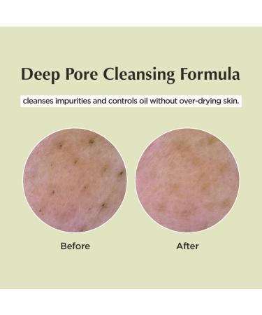 Discover ma:nyo Deep Pore Cleansing Soda Foam 5.07 oz - Elevate Your Style Instantly! - Buy Online on GoSupps.com