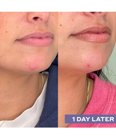 Discover Mario Badescu Repairing Facial Spray With Hypochlorous Acid 4.0 oz - Elevate Your Style Instantly! - Buy Online on GoSupps.com