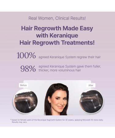 Discover Keranique Hair Regrowth 5% Minoxidil Foam for Women 60-Day Supply 2.11 oz - Elevate Your Style Instantly! - Buy Online on GoSupps.com