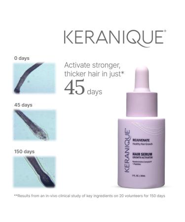 Keranique Growth Activator Hair Serum 1.0 oz - Transform Your Style with the Best Innovation Today! - Buy Online on GoSupps.com