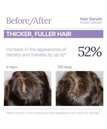 Keranique Growth Activator Hair Serum 1.0 oz - Transform Your Style with the Best Innovation Today! - Buy Online on GoSupps.com