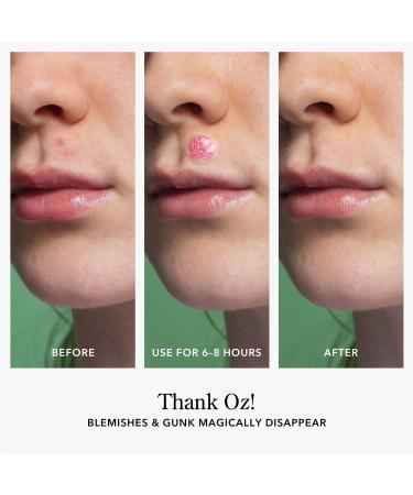 Beekman 1802 Beekman 1802 x Wicked Thank Oz! Blemish Patches - Transform Your Style with the Best Innovation Today! - Buy Online on GoSupps.com