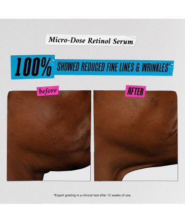 Kiehl's Since 1851 12 Mini Advent-Ures Gift Set - Transform Your Style with the Best Innovation Today! - Buy Online on GoSupps.com