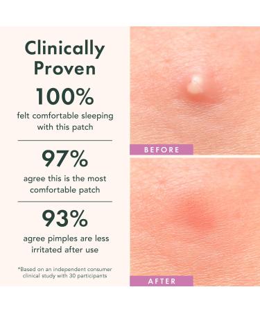 Rael Miracle Patch Overnight Spot Cover 52 ct - Discover Premium Quality Shop now! - Buy Online on GoSupps.com