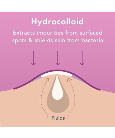 Rael Miracle Patch Overnight Spot Cover 52 ct - Discover Premium Quality Shop now! - Buy Online on GoSupps.com