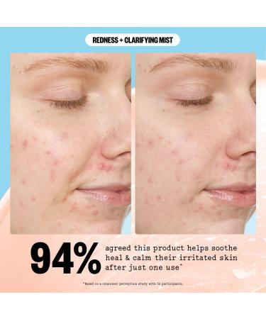 Discover Peace Out Redness Reducing + Clarifying Facial Mist 3.39 oz - Elevate Your Style Instantly! - Buy Online on GoSupps.com