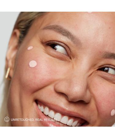 Discover Kate Somerville Breakout Busters Gift Set - Elevate Your Style Instantly! - Buy Online on GoSupps.com