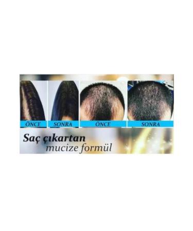 Nova Blue Hair Loss Serum Tonic Water And Shampoo - Buy Online on GoSupps.com