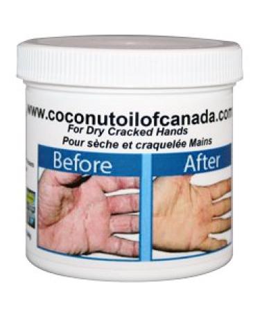 For Dry Cracked Hands