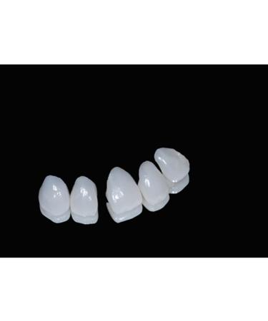 SowSmile Snap-On Smile Veneers for Instant Perfect Dental Care - Whitening Dentures - Buy Online on GoSupps.com