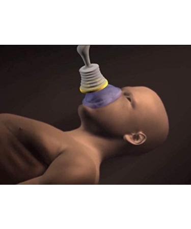 LifeVac Choking Rescue Device Home Kit for Adults and Children - Portable First Aid Choking Device (Pack of 2) - Buy Online on GoSupps.com