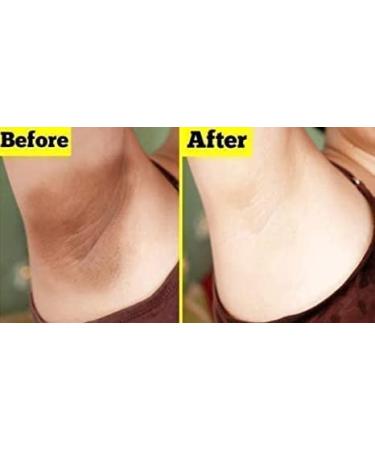 Brightening Cream for Skin, Face, Armpits, Neck, Intimate Areas - 2.0 Ounce - Buy Online on GoSupps.com