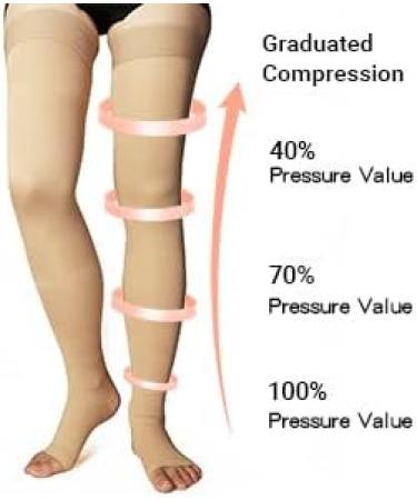 MD Thigh High Compression Stockings - Open-Toe 20-30mmHg Firm Support Socks for Varicose Veins & Swollen Legs - Nude 2XL XXL - Buy Online on GoSupps.com