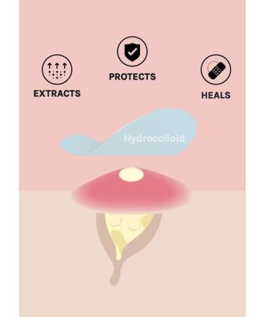 Hydrocolloid Acne Pimple Patch | 72 Fast Healing Dots | Vegan Cruelty-Free Spot Stickers for Zits & Blemishes - Skin & Face Care - Buy Online on GoSupps.com