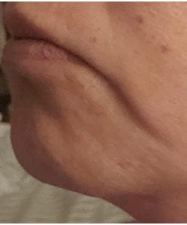 Buy 100% Natural Ruby Oil - Anti-Aging Moisturizer for Hydrated Skin | International Shipping Available - Buy Online on GoSupps.com