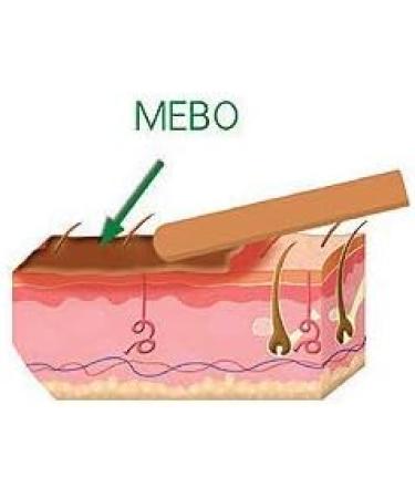 MEBO Burn Cream Skin Ointment 75g Tube - Wound & Scar Care First Aid Health Beauty - Buy Online on GoSupps.com