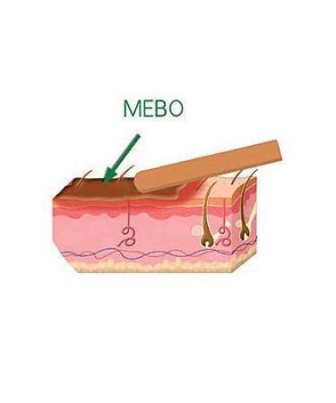 Egypt MEBO Burn Cream Ointment 75g - Fast Healing for Wounds & Scars - Buy Online on GoSupps.com