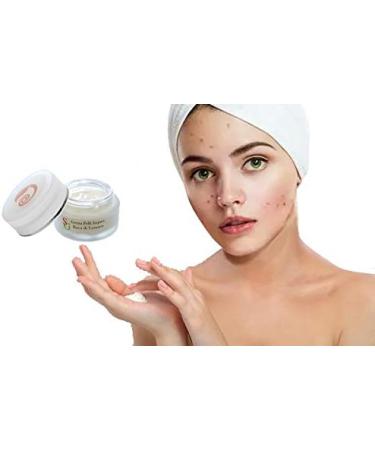  Snail Green Snail Green Face Acne Cream enriched with Rosemary Burdock Orange and Thyme Extracts. Purifying Blackhead-Reducing Anti-Blemish. Made in Italy. 50 ml - Buy Online on GoSupps.com