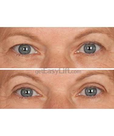 EasyLift Instant Eye Lift - Visible Results in Seconds - Buy Online on GoSupps.com