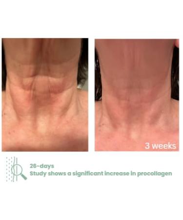 NECK+ Regenerative Cream Collagen Boosting Neck Cream Firms Tightens Lifts with Peptides & Growth Factor Complex Gentle on Skin Clinically Tested 1.7 fl oz (Full-Size) Pack of 1 1.7 Fl Oz (Pack of 1) - Buy Online on GoSupps.com