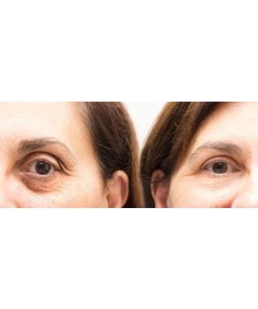 60 (30 pairs) Collagen and Hyaluronic Acid Eye Pads Face Mask Remove Dark Circles and Fine Lines Reduce Wrinkles Crows Feet Reduce Eye Bags and Puffiness 24k - Buy Online on GoSupps.com
