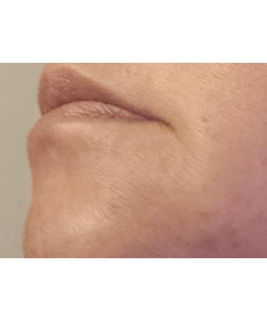 Buy 100% Natural Ruby Oil - Anti-Aging Moisturizer for Hydrated Skin | International Shipping Available - Buy Online on GoSupps.com