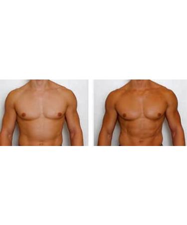 Deep Golden Self-Tanning Mousse + Bronzer - Achieve Flawless Tan | 5.0 Oz - Fast International Shipping - Buy Online on GoSupps.com