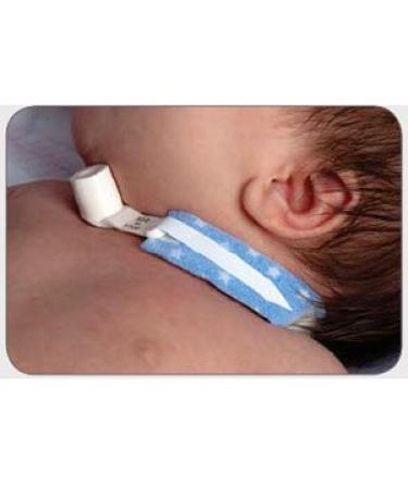 Dale Medical Products Inc Da241Bx Dale 241 Pediprints Trach Tube Holder, Up To 18quot,Dale Medical Products Inc - Box 10