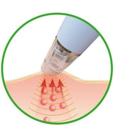 Effective Mosquito Bite Relief Tool - Battery-Powered Suction Pump for Instant Itch Relief | Compare to Bug Bite Thing - Buy Online on GoSupps.com