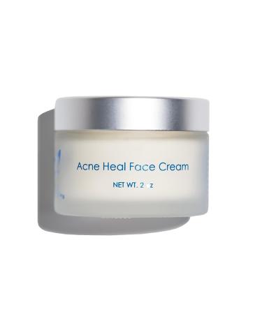 Acne Heal Face Cream For Oily And Acne-Prone Skin| Daily Moisturizer Minimizes And Prevents Breakouts| Reduces Surface Impurities| Vegan Cruelty Free (2oz)