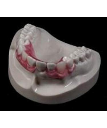 Custom Pink Valplast Partial Denture - Affordable & Flexible - Buy Online on GoSupps.com