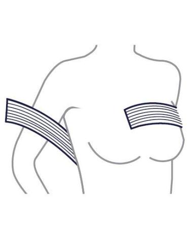 CAREFIX Implant Stabilizer Band (8113) White | TYTEX Post-Surgery Breast Implant Support | Chest Compression & Augmentation Strap - Buy Online on GoSupps.com