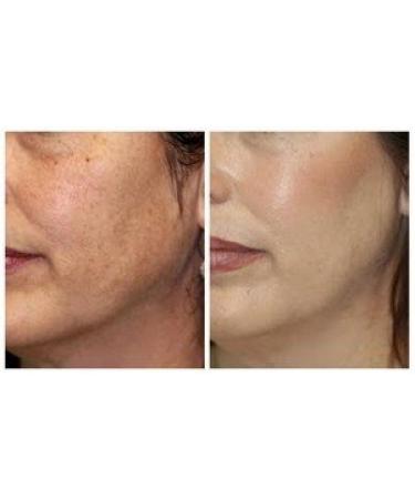 Mary Kay Timewise Microdermabrasion Plus Set - Professional Exfoliating Skincare Treatment - Buy Online on GoSupps.com