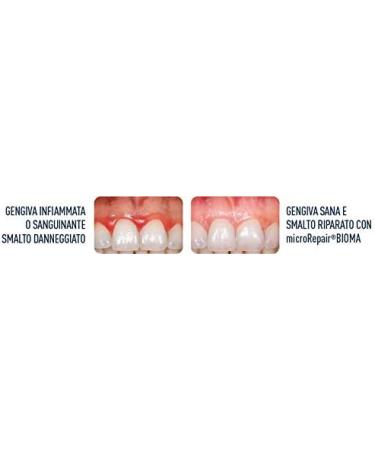 Buy Biorepair Peribioma Pro Advanced Toothpaste - 3 x 75 ml for Siblings | Balance Microbiot Problems | International Shipping Available - Buy Online on GoSupps.com