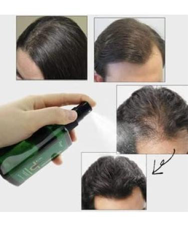 Anti-Hair Loss Spray | Hair Nutrient Solution 120 ml - Boost Hair Growth & Strengthen Thinning Hair - Buy Online on GoSupps.com