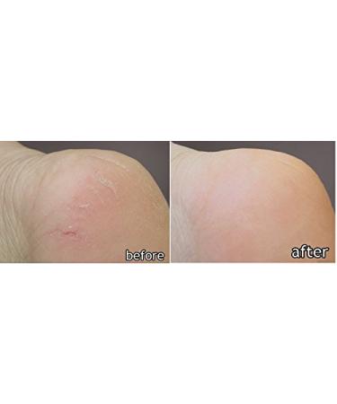 DK ELAN Silky Smooth Special Set - Ultimate Relief for Dry Rough Itchy Skin | Body Hand & Foot Care - International Shipping Available - Buy Online on GoSupps.com