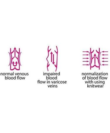 Compression Stockings for Pregnant Women - 1 Class, 16-18 mmHg Compression, Better Blood Circulation, Prevent Varicose Veins - Beige, Small (37-38) - Buy Online on GoSupps.com