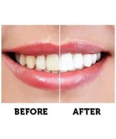 Activated Charcoal Teeth Whitening Powder - 100% Organic Fluoride-Free and Natural Toothpaste for Bright White Smile - Best Teeth Whitener Kit - Buy Online on GoSupps.com