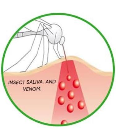 Effective Mosquito Bite Relief Tool - Battery-Powered Suction Pump for Instant Itch Relief | Compare to Bug Bite Thing - Buy Online on GoSupps.com
