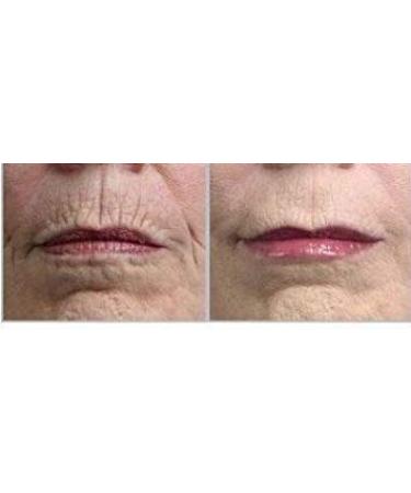 Buy Gaba Freeze 24/7 Skin Tightening Cream - 17% GABA Hyaluronic Acid DMAE & CoQ10 - Paraben-Free | International Shipping - Buy Online on GoSupps.com
