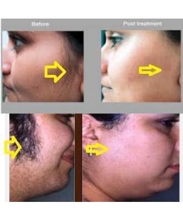 Natural Health and Herbal Products Multani Mitti Flavour Waxing Powder Instant Hair Remover for All Types of Hair & Skin Hands Legs Underarms Bikini (Private Part) Area (Unisex adult 100 g) - Buy Online on GoSupps.com