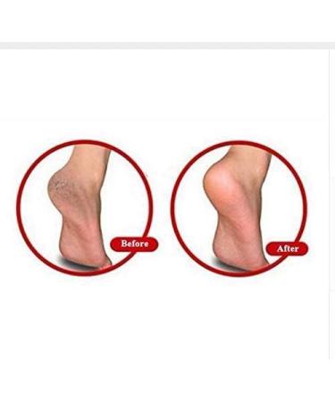 Buy Gel Heel Socks - Silicone Moisturizing Pain Relief Sleeves for Men & Women | Dry & Cracked Foot Protection - Buy Online on GoSupps.com
