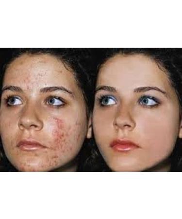 100% PURE MOROCCAN JAMAICAN BLACK ARGAN OIL 125ml - With FRAGRANCE - By SONIK PERFORMANCE | P+50 ORGANIC - For Face Hair Body and Nails. Great for Dermatitis Psoriasis Eczema Brittle Nails Dry Hair & Scalp Burns Pain Stretch Marks Rosacea Cuts Scars Anti- - Buy Online on GoSupps.com
