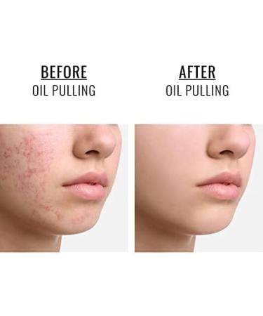 Oliveda I24 Natural Mouth Pulling Oil with Moroccan Mint - Ayurvedic Oil Pulling Treatment 200ml | Tooth Oil & Mouthwash - Buy Online on GoSupps.com