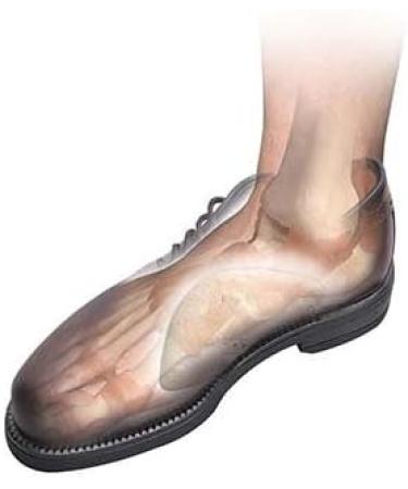 Medium Hapad Scaphoid Arch Support Insoles - 12 Pairs for Flat Feet Pain Relief - Buy Online on GoSupps.com