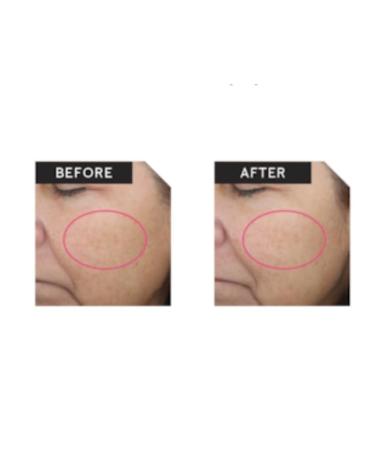 Buy Mary Kay Clinical Solutions Retinol Set 0.5 & 2.5 - Best International Shipping - Buy Online on GoSupps.com