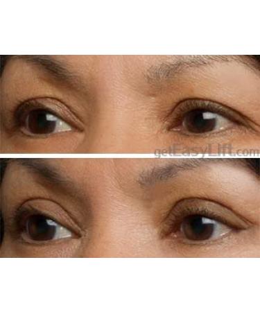 EasyLift Instant Eye Lift - Visible Results in Seconds - Buy Online on GoSupps.com