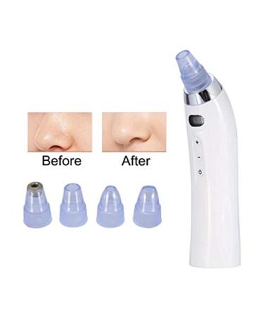 DermaSuction 4-in-1 Blackhead Whitehead Extractor for Men and Women - Multi-function Remover Device - Buy Online on GoSupps.com