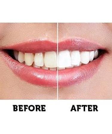 Active Wow 24k White Teeth Whitening Kit - LED Light, All Natural Formula, Mint Flavor - 30 Treatments - Buy Online on GoSupps.com