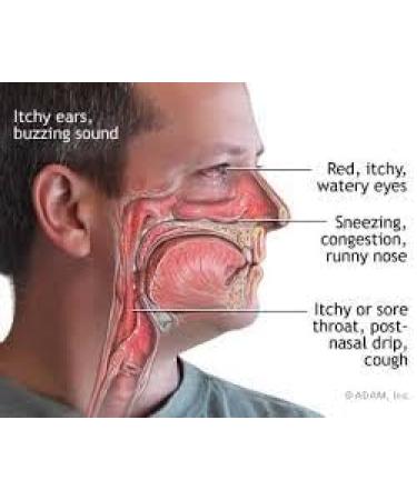 NaturalyPure ClearSinus - Allergy and Sinus Congestion Relief. Runny Stuffy Itchy Nose and Eyes. Sore Throat and Cough. 120 Vegan Capsules. - Buy Online on GoSupps.com